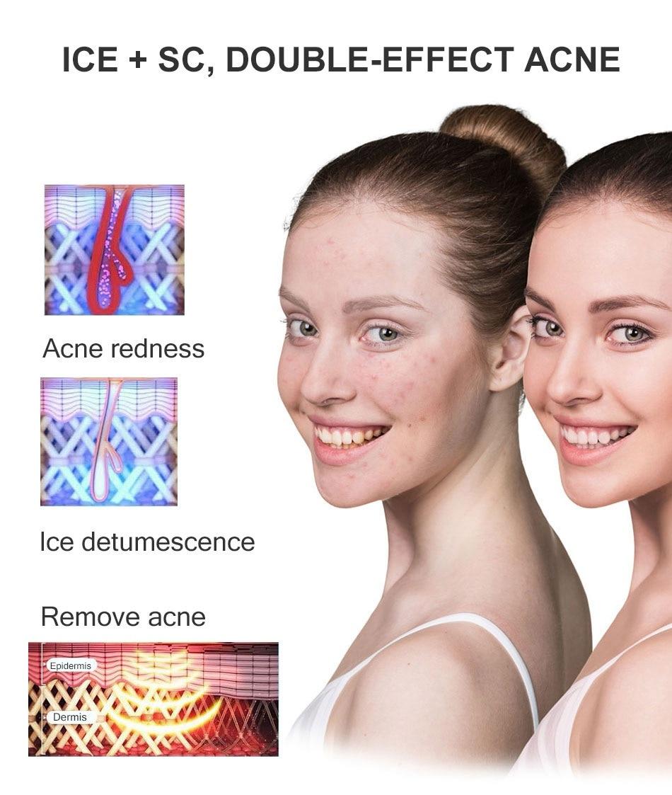 Osenyuan 4in1 Icecool IPL Epilator Laser Hair Removal Permanent For Face Body Leg Bikini Electric Depiladora Laser Epilator
