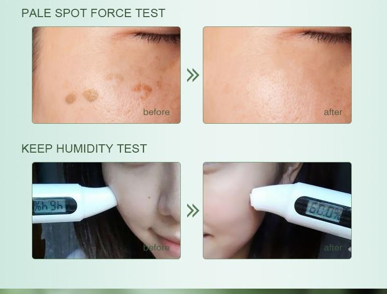 Powerful Whitening Freckle Cream 40g Remove Melasma Acne Spots Pigment Melanin Dark Spots Face Lift Firming Face Care Cream skin