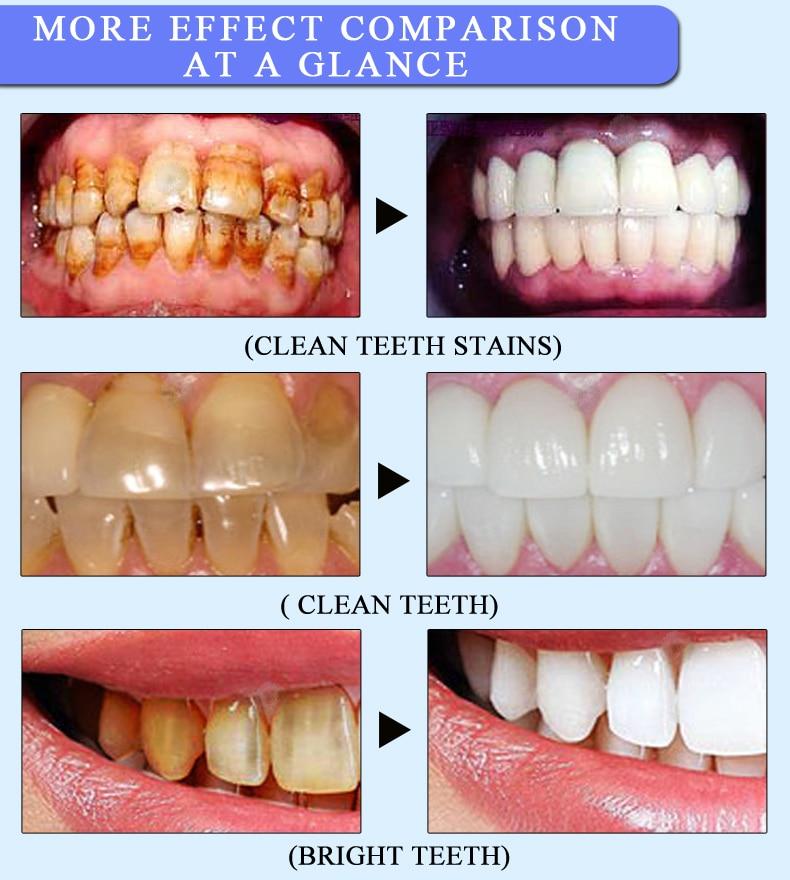 5ml Teeth Whitening Essence Remove Plaque Tooth Stains Teeth Bleaching Oral Cleaning Dental Care Products