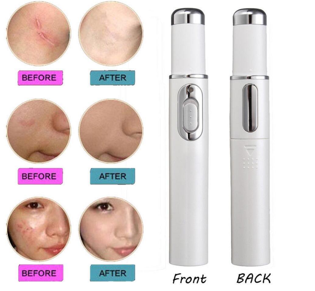 KD-7910 Protable Beauty Home Machine Acne Treatment Aging Therapy Anti-Wrinkle Scar Varicose Veins Laser Blue Light Avne Pen