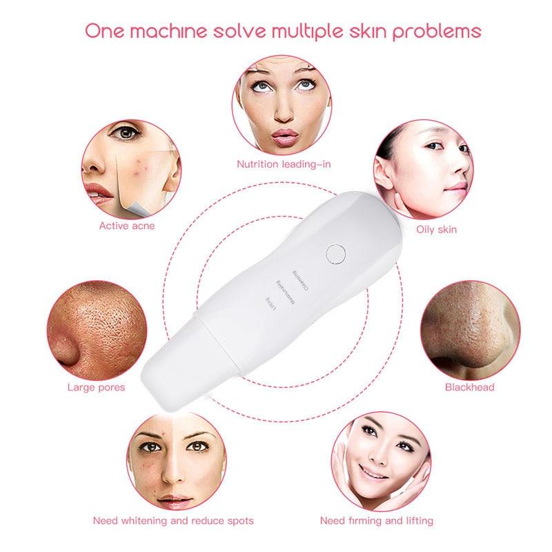 Ultrasonic Skin Scrubber Deep Cleaning Face Scrubber Vibrating Facial Cleansing Skin Spatula Peeling Beauty Instrument Device