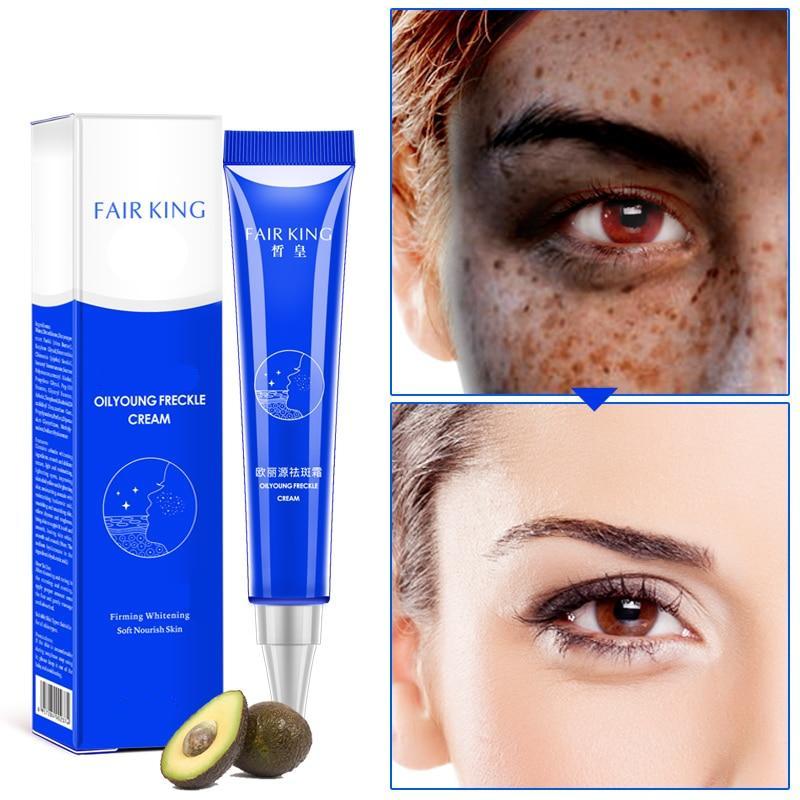 Powerful Whitening Freckle Cream 20g Remove Melasma Acne Spots Pigment Melanin Whitening Moisturizing Skin Care TSLM2