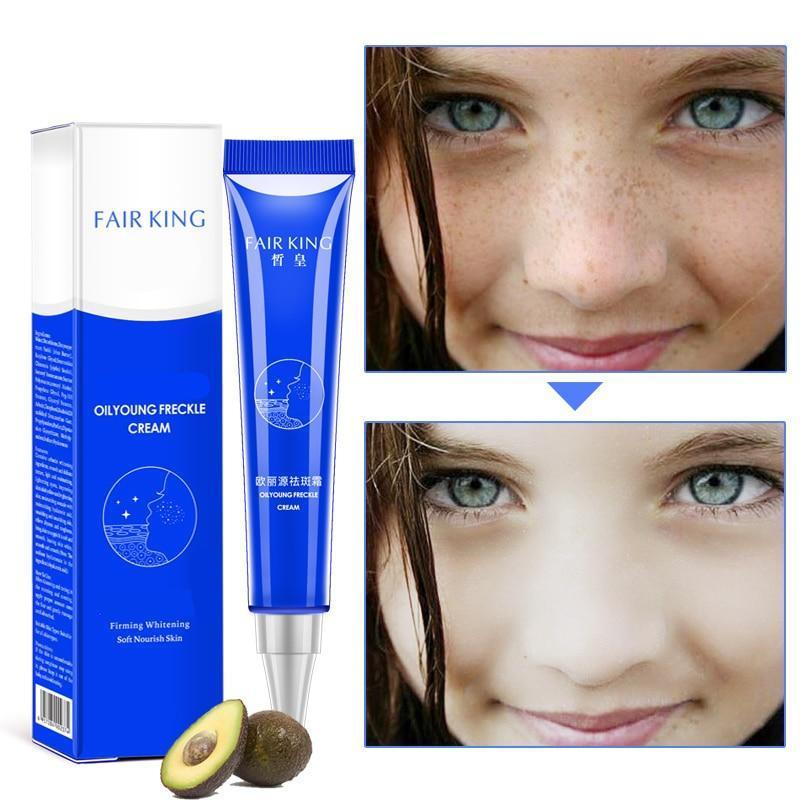 Powerful Whitening Freckle Cream 20g Remove Melasma Acne Spots Pigment Melanin Whitening Moisturizing Skin Care TSLM2